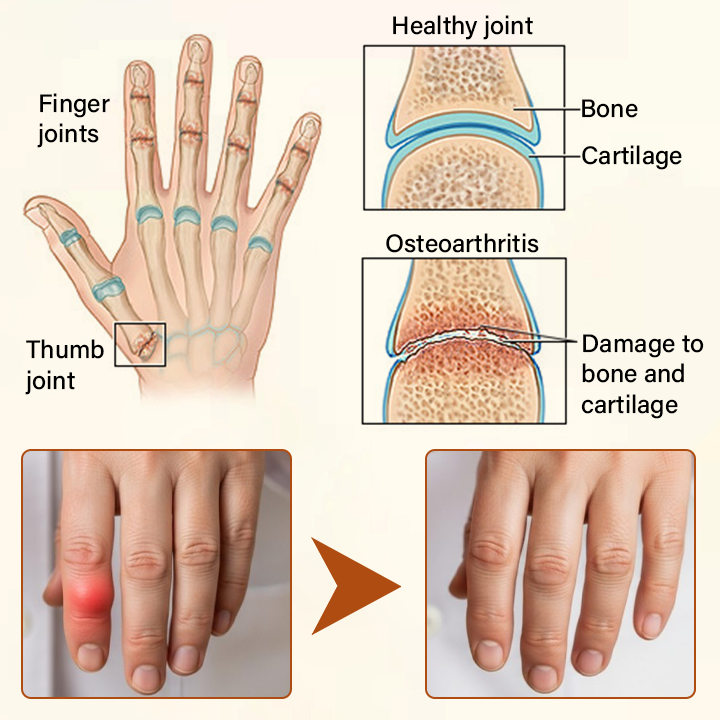 TUMLY® VenomEase Joint Cream