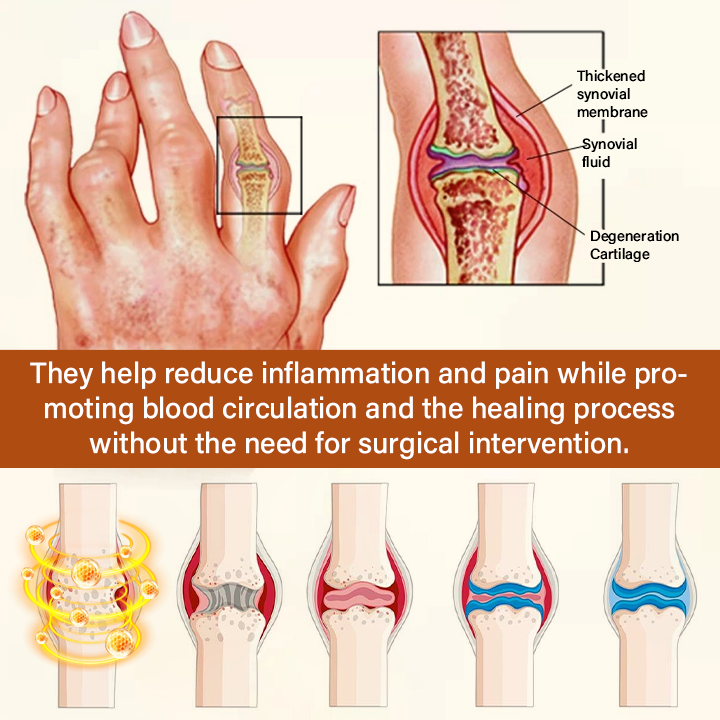 TUMLY® VenomEase Joint Cream