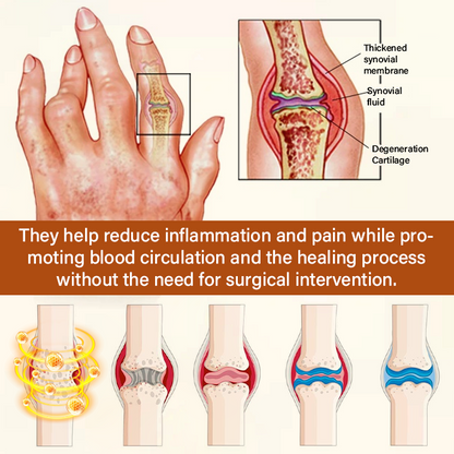 TUMLY® VenomEase Joint Cream