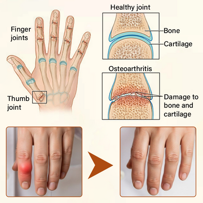 TUMLY® VenomEase Joint Cream
